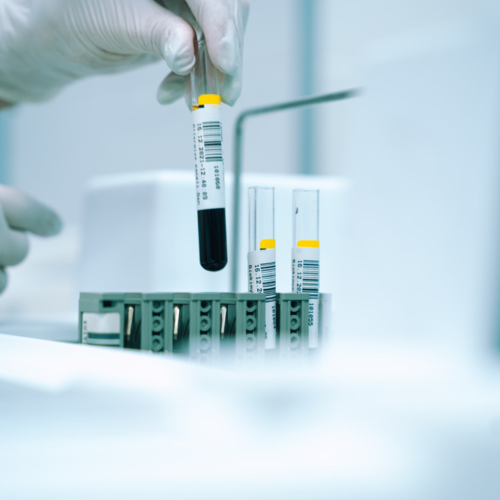 Wir unterstützen internationale Projekte im Bereich der klinischen Forschung. Wir liefern Großhändlern und Pharmaherstellern Vergleichspräparate (Comparator Drugs) für klinische Studien. Reagenzgläser im Labor